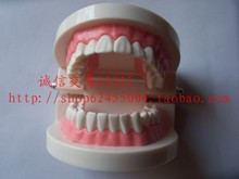 牙科材料 牙齿教学模型 牙齿模型 练习全口模型 牙齿美白联系用